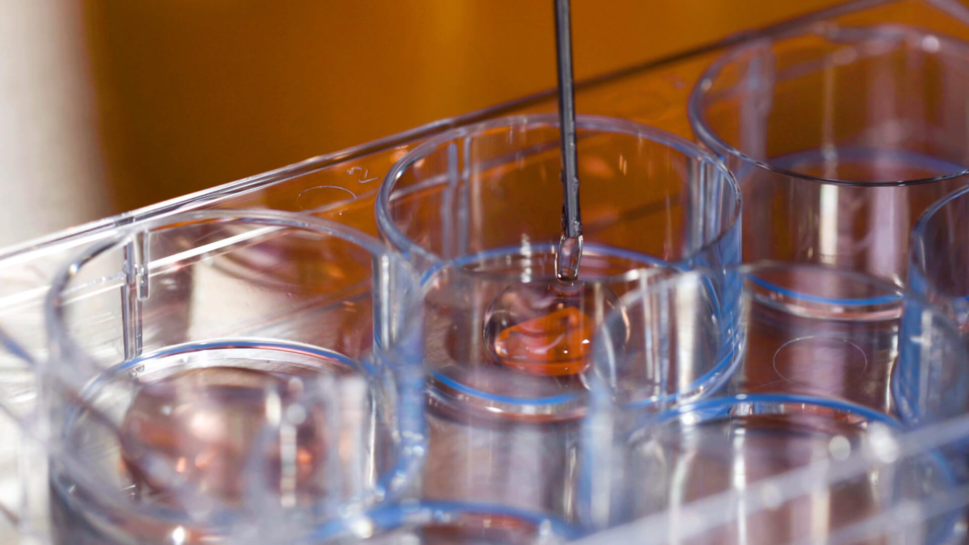 Ensayo de unidades formadoras de colonias en SmartDish de StemCell